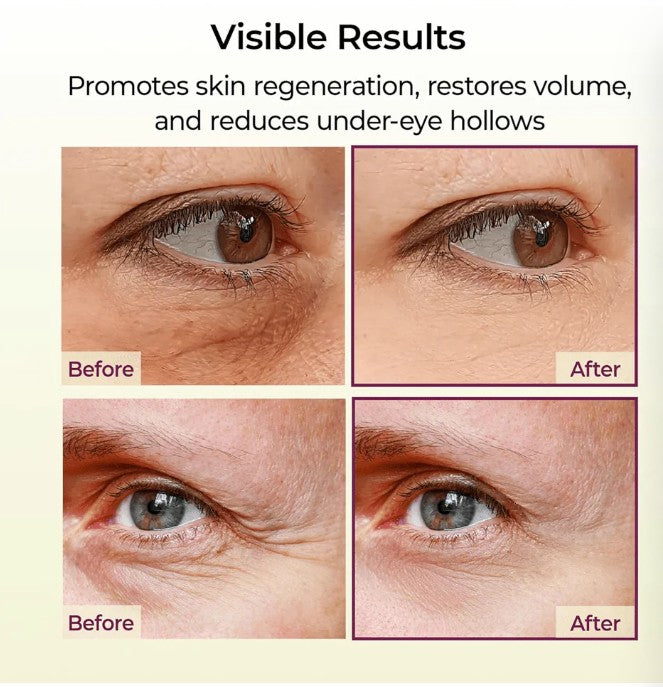 Dr. Melaxin Cemenrete Calcium Multi Balm 9g – Korean Collagen Face & Eye Stick | All-in-One Wrinkle & Hydration Care.